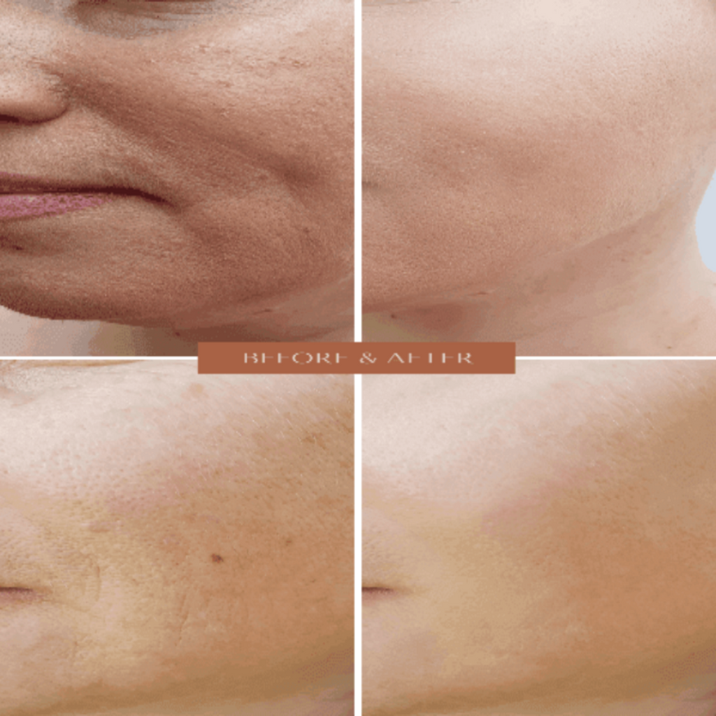 Organic Two-Step Anti-Aging Facial System - Wash and Moisturizer - For WOMEN
