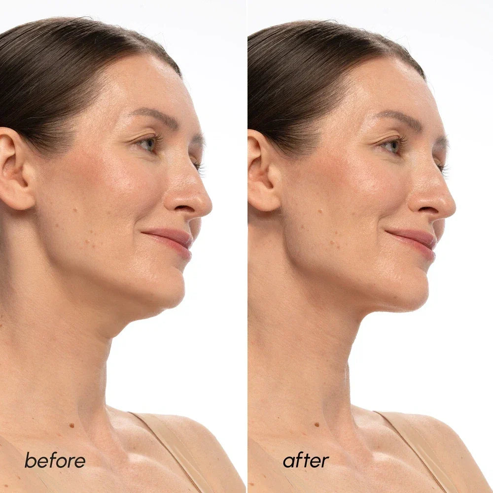 PDRN V-line Lifting Mask 20 PCS