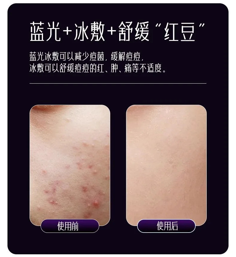 EMS, Cryo & LED Facial Lifting Device