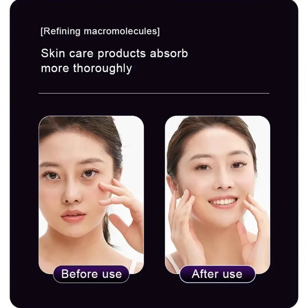 EMS, Cryo & LED Facial Lifting Device