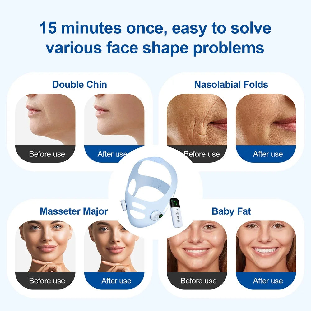 EMS Jaw & Chin Massage Device