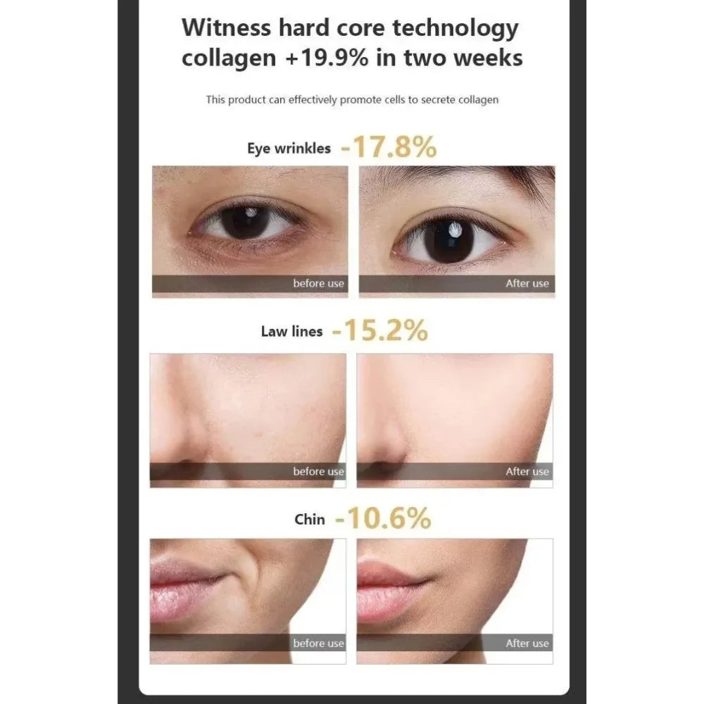 7-in-1 RF & EMS Facial Tightening Device