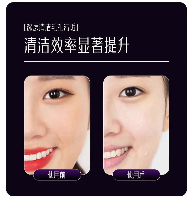 EMS, Cryo & LED Facial Lifting Device