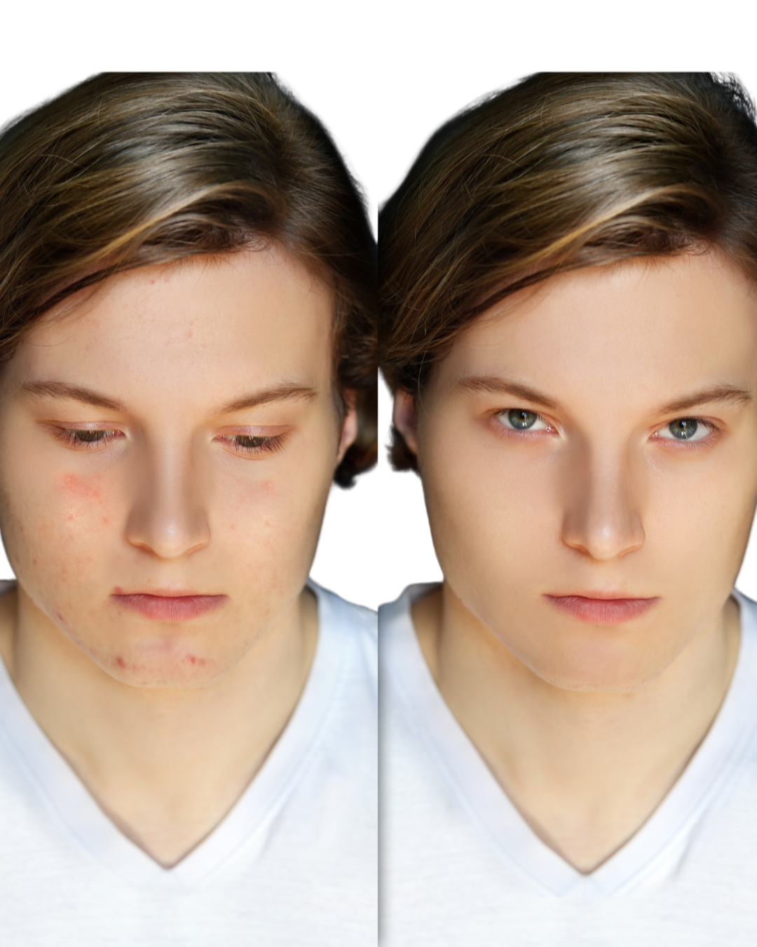 Rejuvenating Anti-Acne Organic Facial Scrub